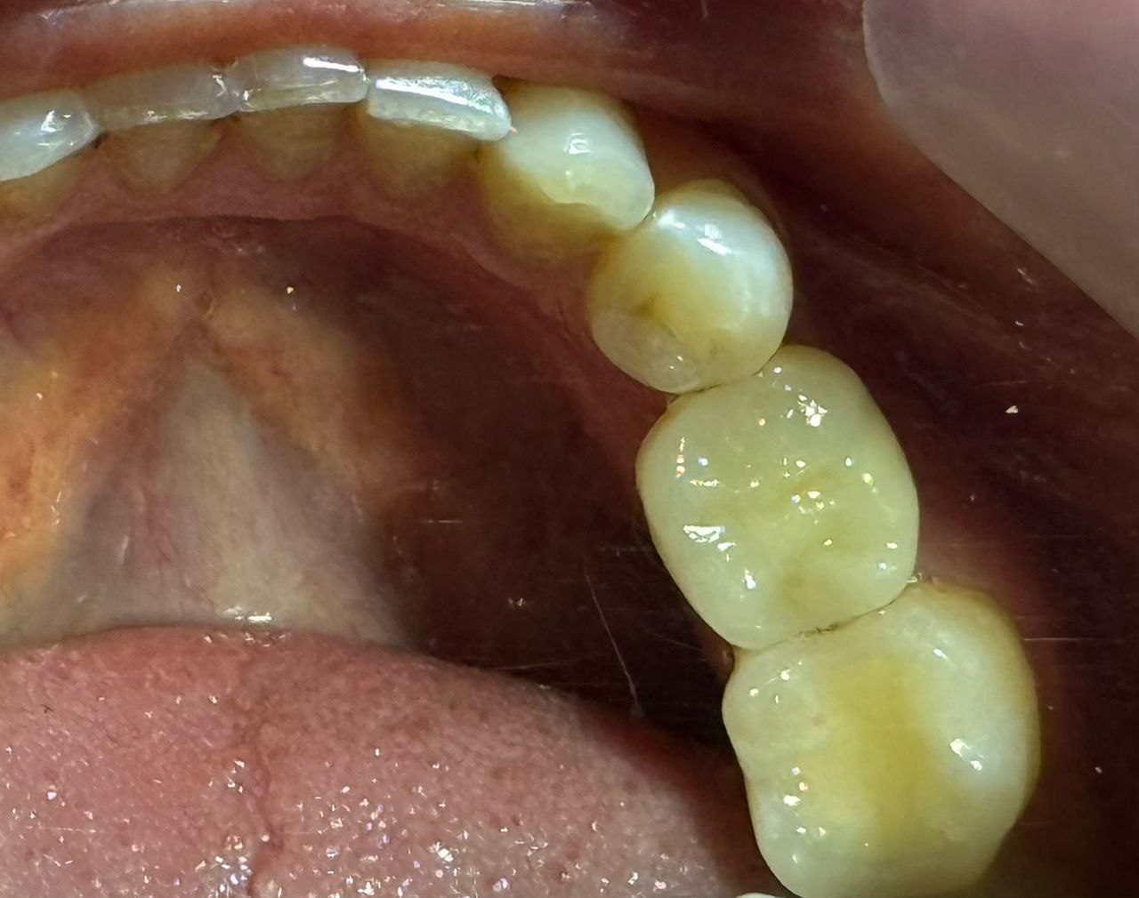 نصب پوش در کلینیک اعلمی